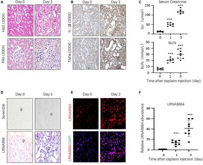 Long Non-coding RNA LRNA9884 Promotes Acute Kidney Injury via Regulating NF-kB-Mediated Transcriptional Activation of MIF